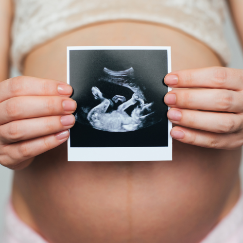 Femme enceinte