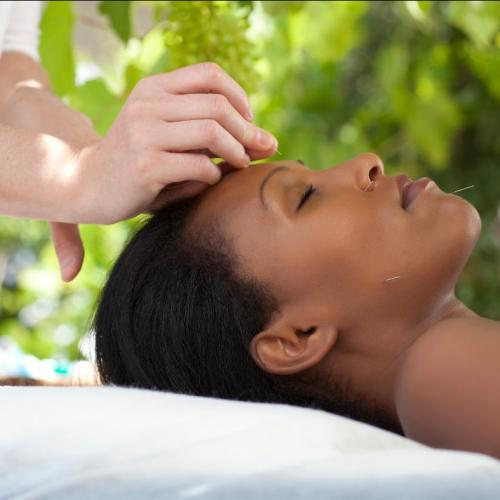 Femme pendant séance d'acupuncture