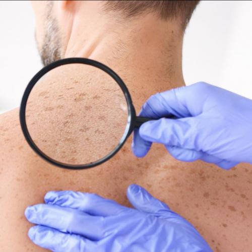 Examen dermatologique d'un patient 